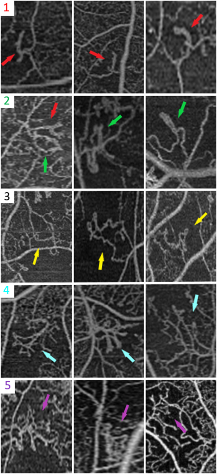 Fig. 4