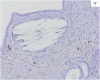 Fig. 3 (B)