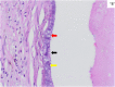 Fig. 2 (B)