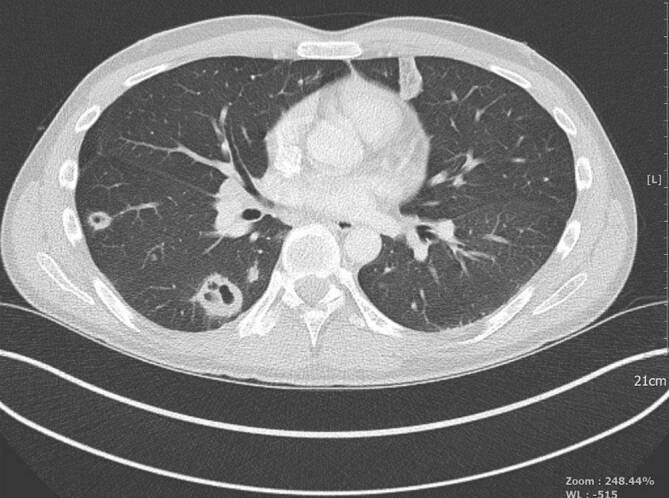 graphic file with name 740_2020_339_Fig1_HTML.jpg