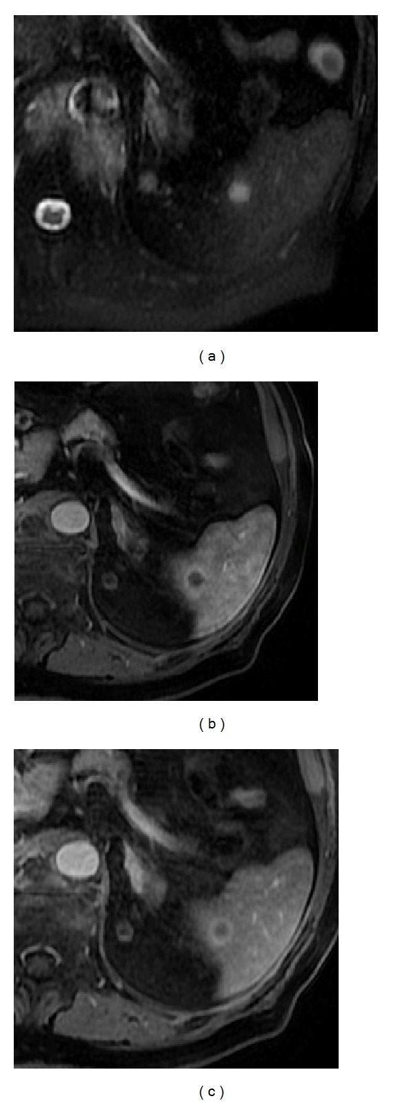 Figure 17