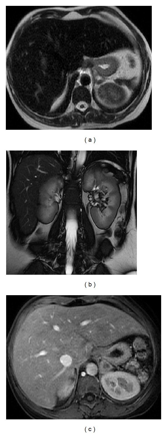 Figure 22