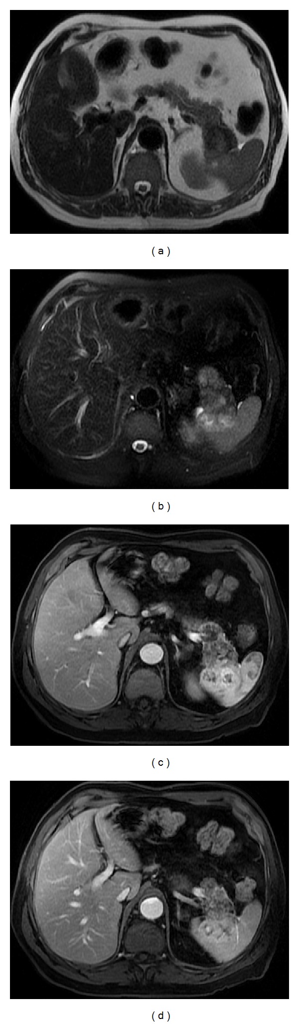 Figure 18