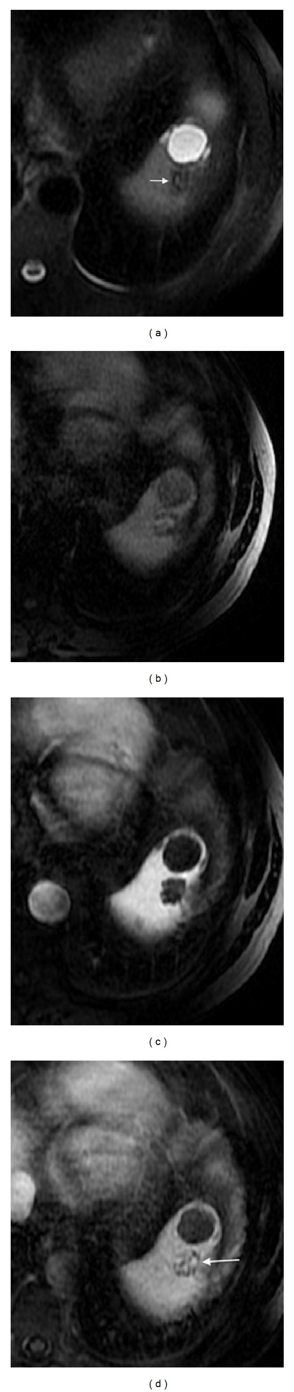 Figure 15