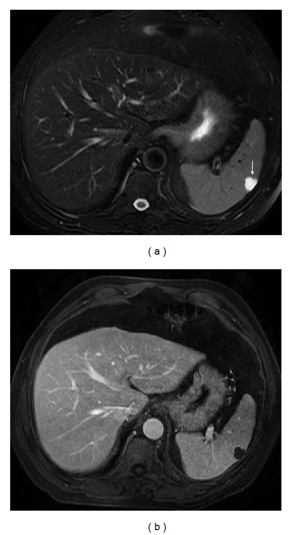 Figure 11