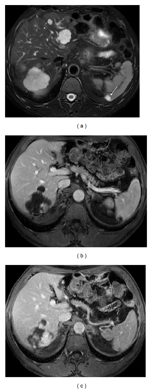 Figure 13