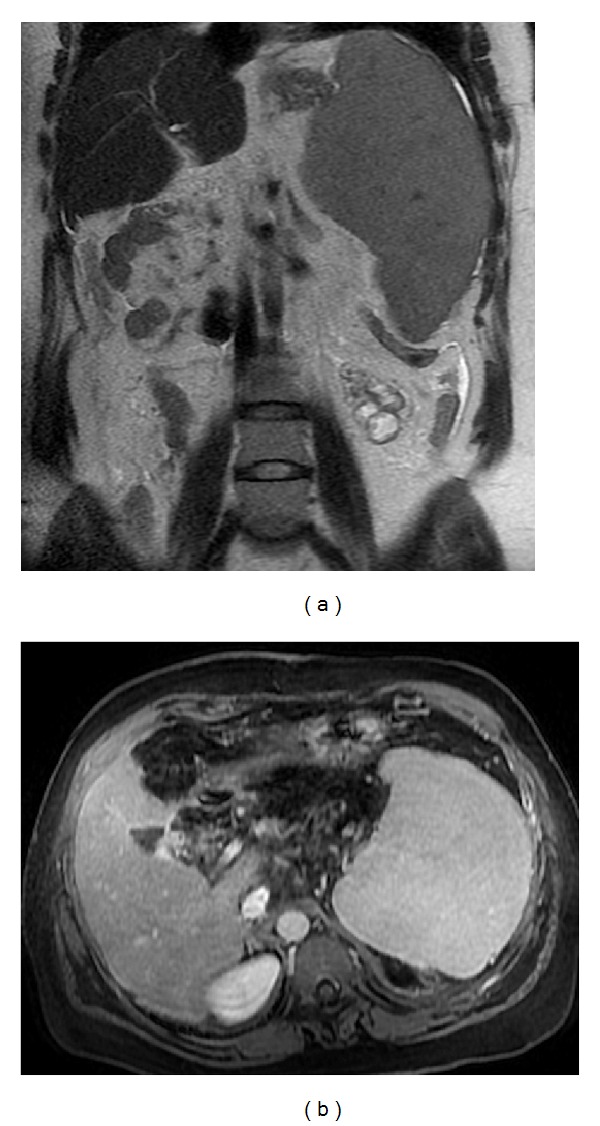 Figure 19