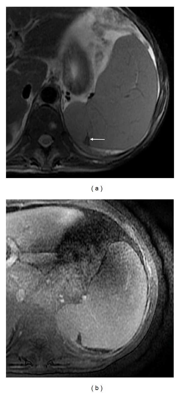 Figure 9