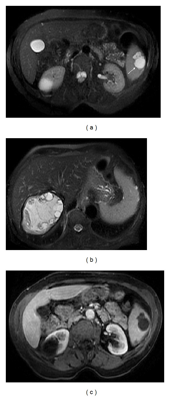 Figure 12