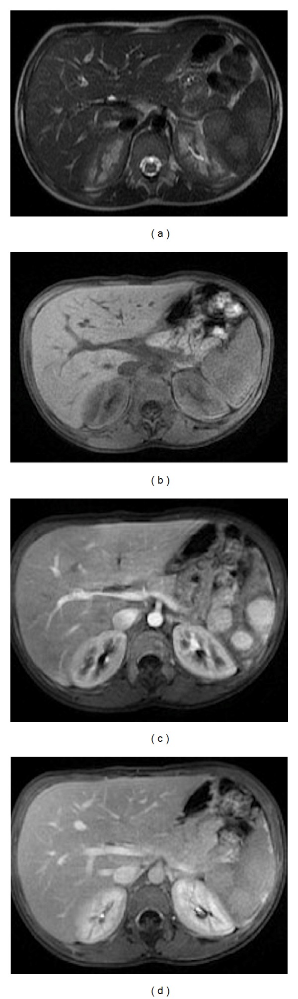 Figure 14