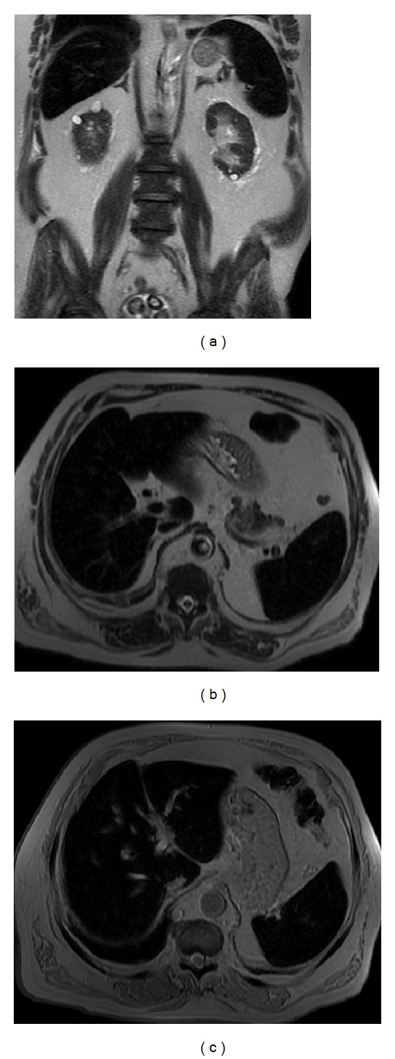 Figure 21