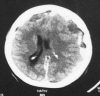 Fig. 3