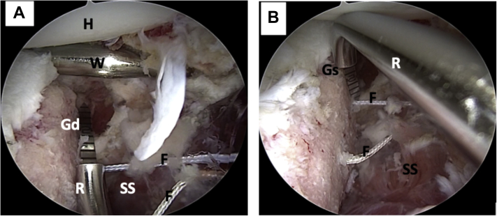 Fig 10