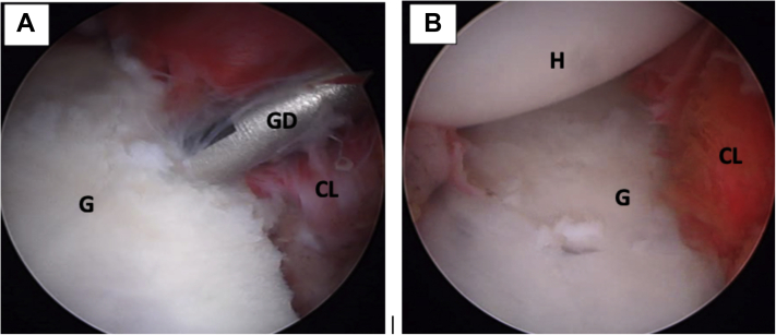 Fig 18