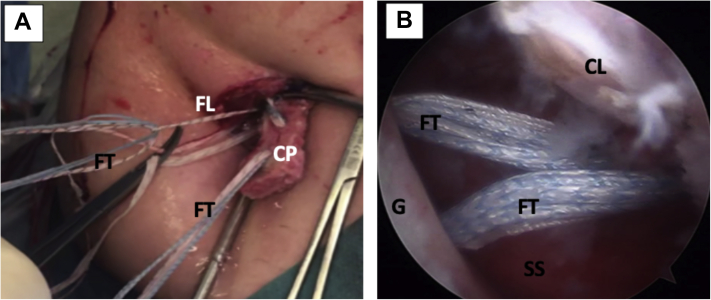 Fig 15