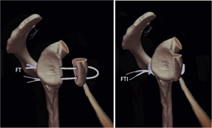 Fig 20