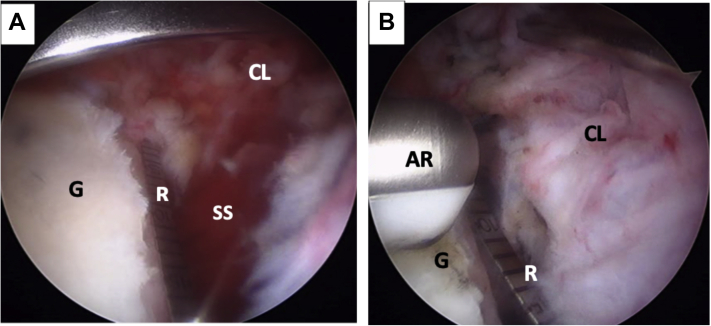 Fig 6