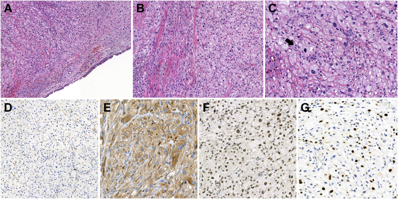 Fig. 3