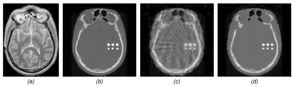 Figure 14