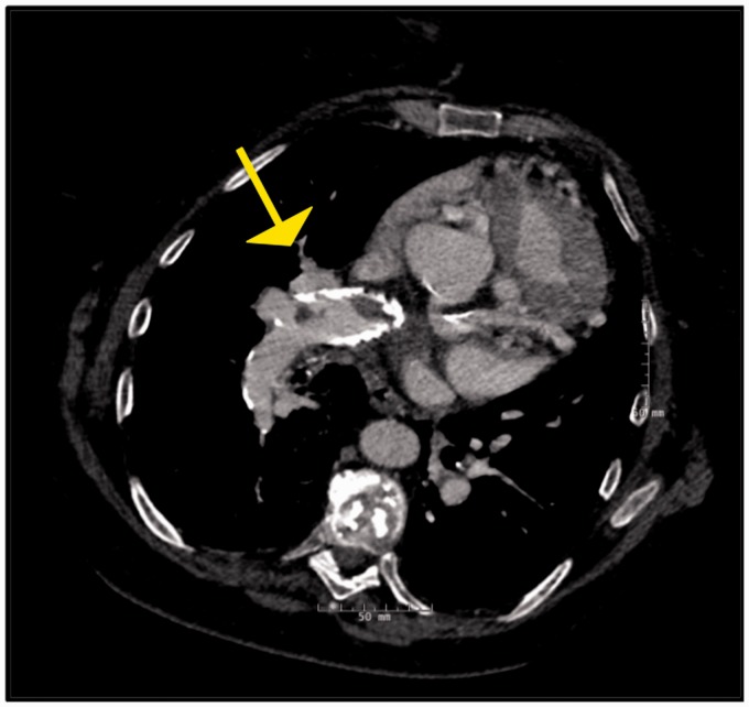 Fig. 1.