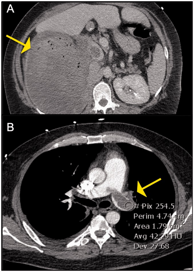 Fig. 11.