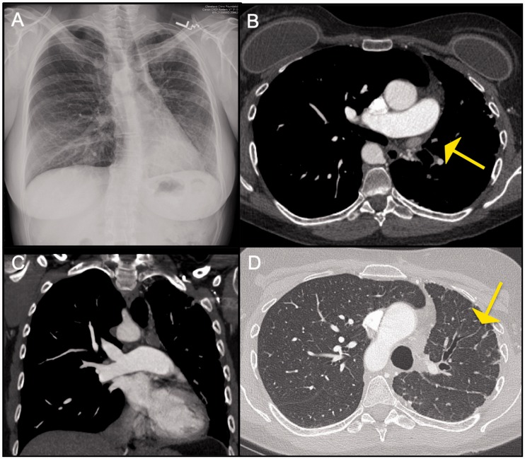 Fig. 12.