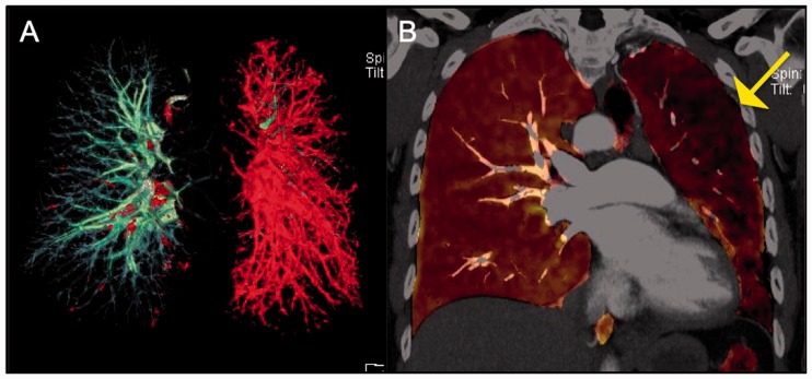 Fig. 13.