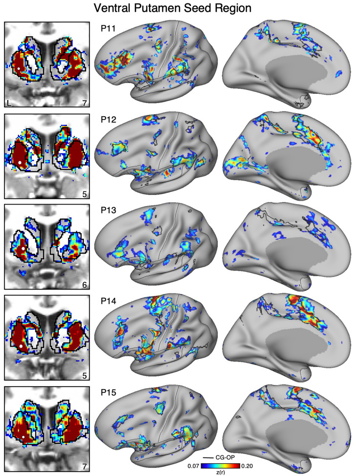 Figure 14.