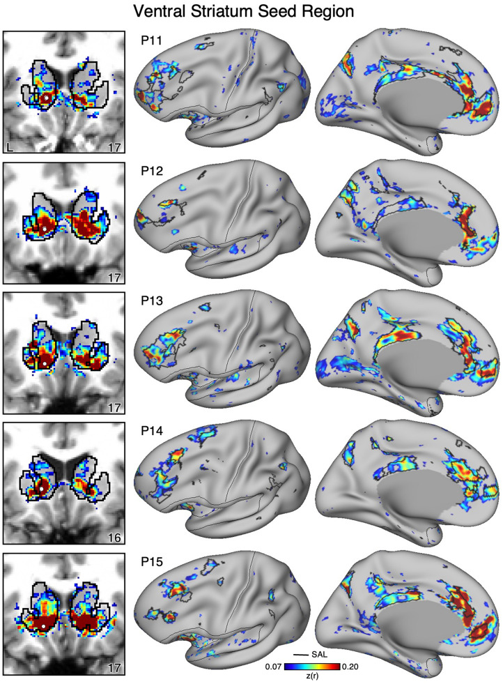 Figure 11.