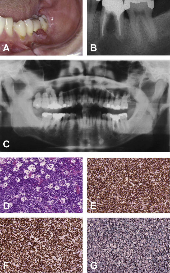 Figure 1