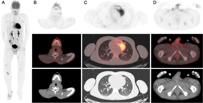 graphic file with name 259_2022_6023_Figa_HTML.jpg