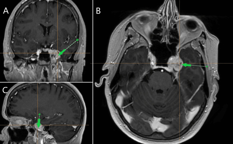 Figure 2