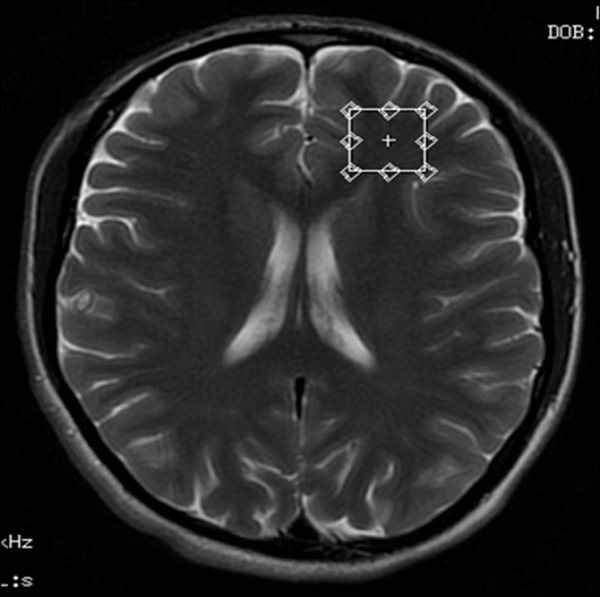 Figure 2.