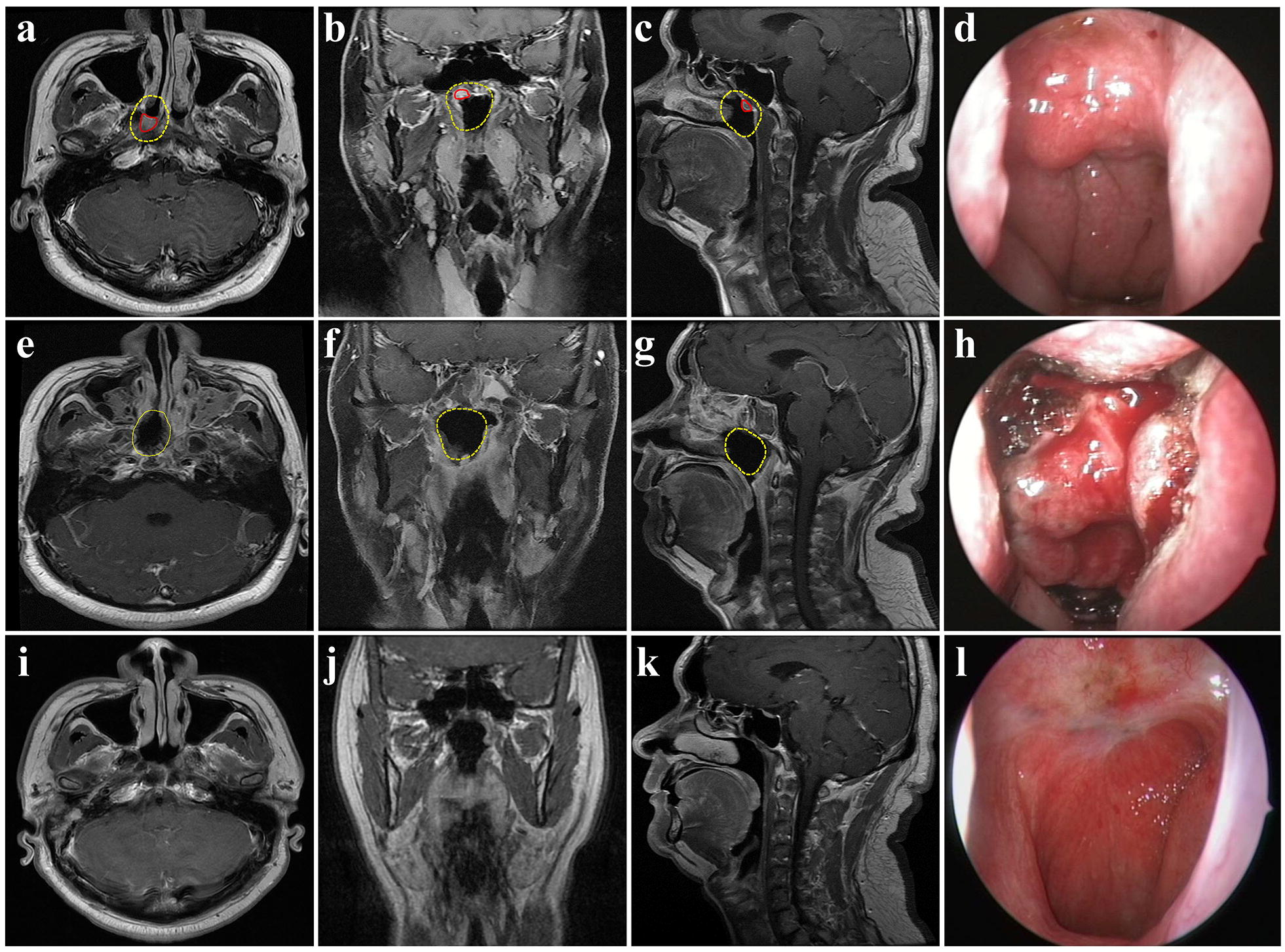 Fig. 2