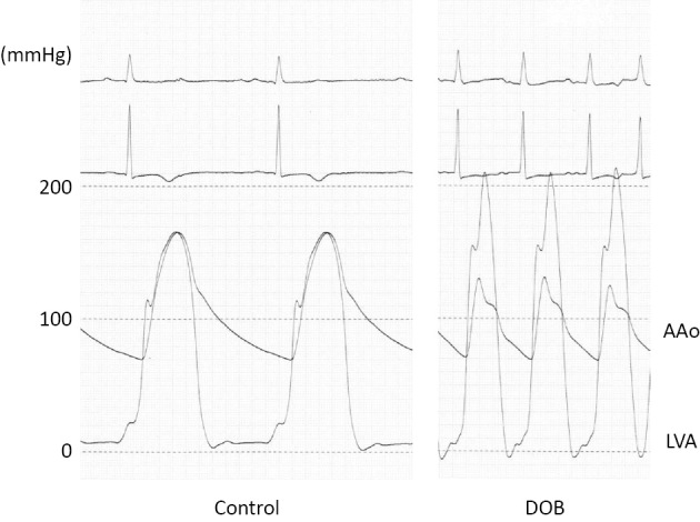 Figure 1D.