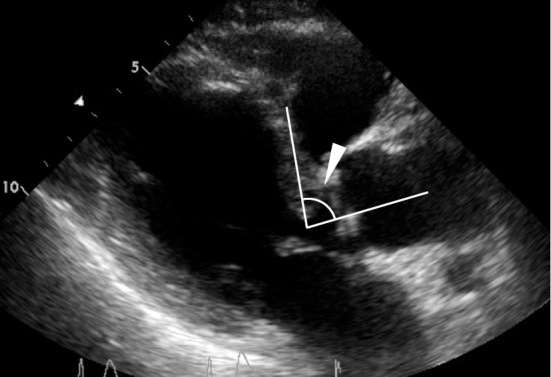 Figure 1C.