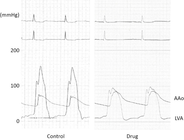 Figure 1B.