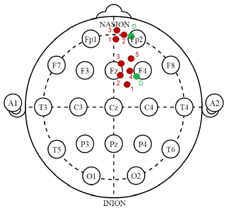 Fig. 1