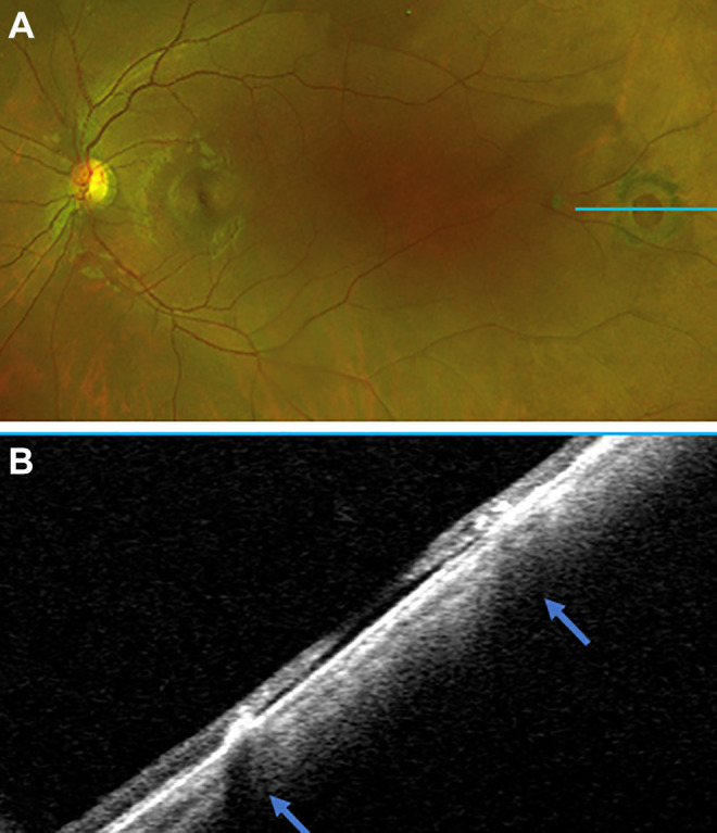 Figure 5.