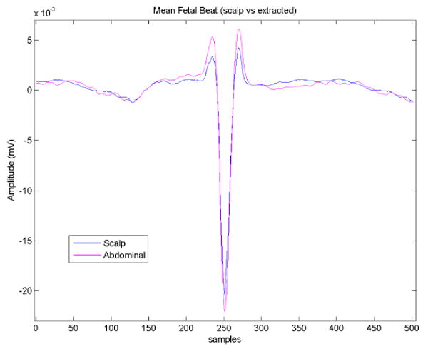 Figure 16