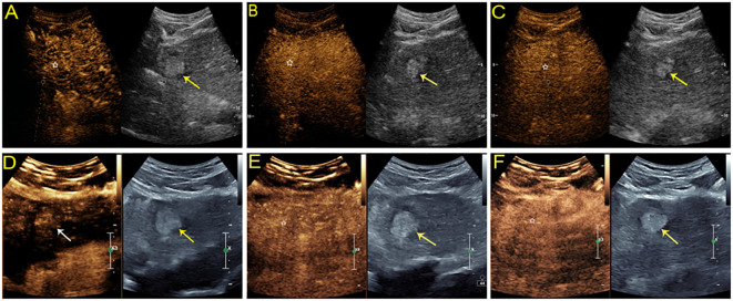 Figure 4