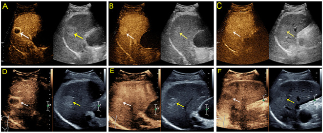 Figure 3