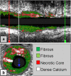 Fig. 3