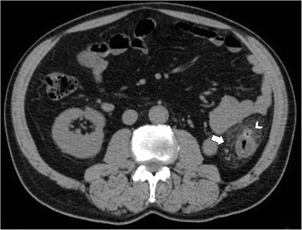 Fig. 11