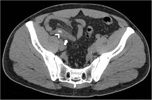 Fig. 12