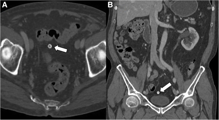 Fig. 8