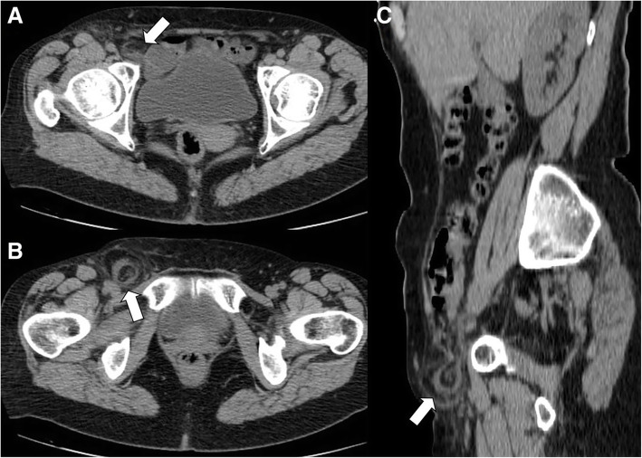 Fig. 10