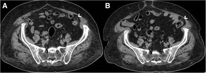 Fig. 6