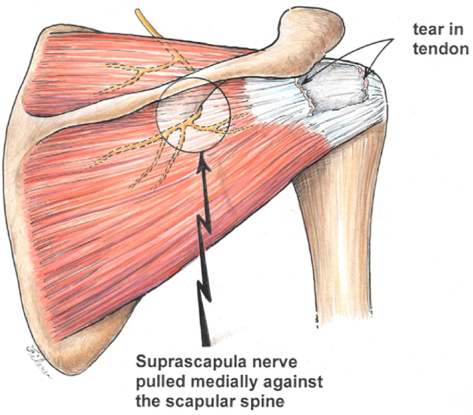 Fig. 1