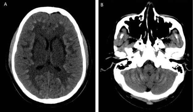 Fig 1.